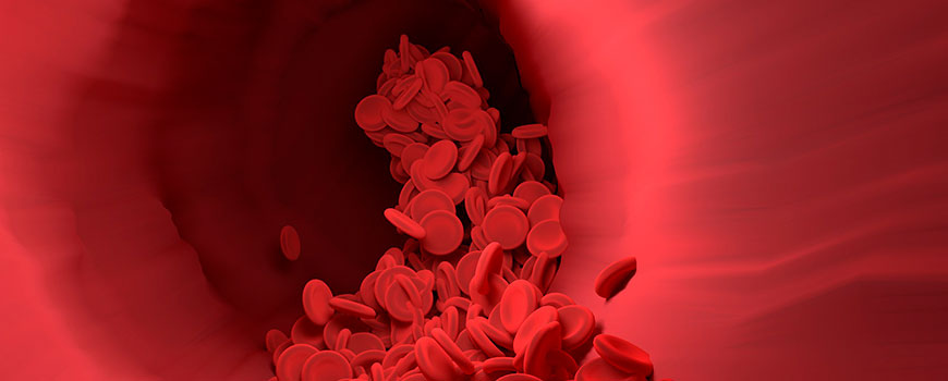 investigación ELA biomarcadores sangre